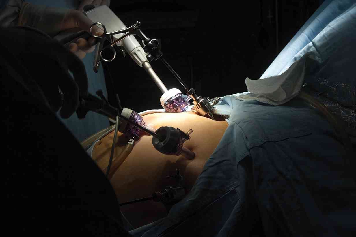 <p>Portrait of gastric bypass surgery in hospital</p>
